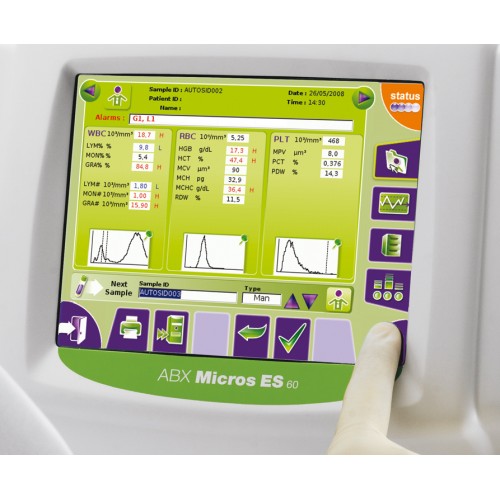 Гематологічний аналізатор ABX Micros ES 60 (3 DIFF, 19 параметрів)